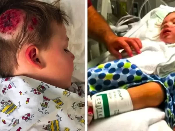 this-little-boy-was-shaky-after-hitting-his-head.-then-doctors-made-an-alarming-discovery