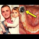 dentists-found-out-the-reason-of-this-father’s-death-after-ignoring-a-toothache