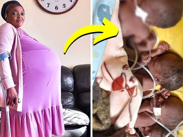 mom-gives-birth-to-10-babies.-doctors-were-devastated-when-they-realized-one-of-them-is-not-a-baby!