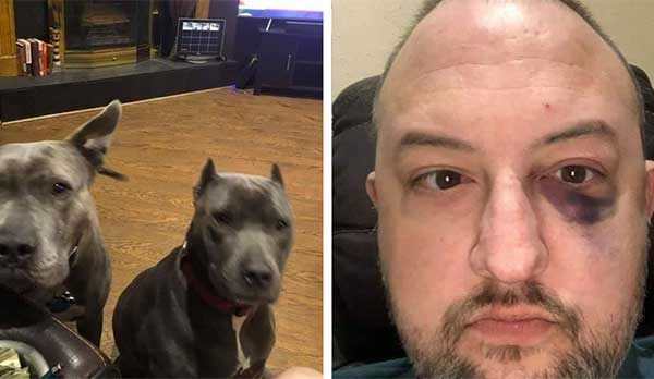 pit-bulls-rescued-their-owner’s-life-during-an-attempted-robbery