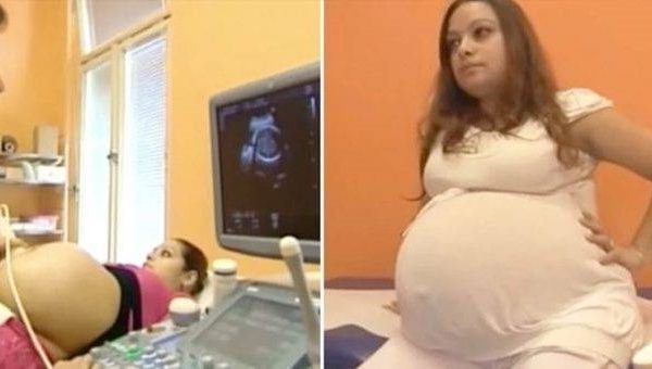 a-23-year-old-mother-made-history-with-a-birth-that-occurs-just-once-every-480-years