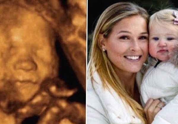 after-losing-baby-girl,-woman-looks-at-son’s-ultrasound-and-sees-her-face