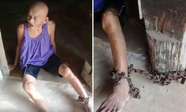 elderly-grandmother-with-dementia-and-alzheimer’s-found-cruelly-chained-to-door