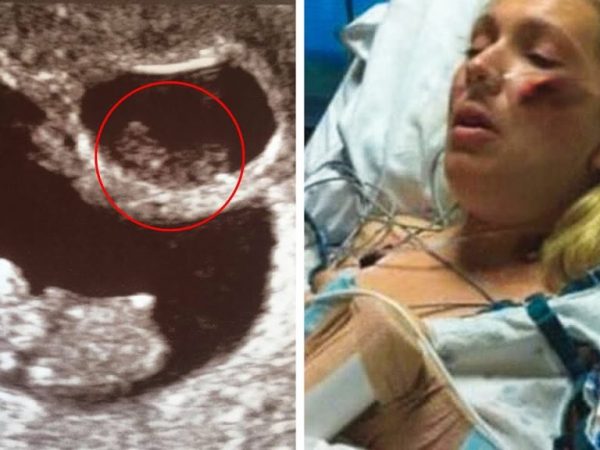 mother-dies-pregnant-then-her-husband-sees-something-strange